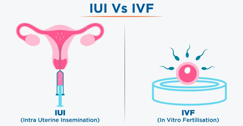 IVF and IUI Which Is Better