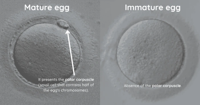 What Does Mature Eggs Mean in IVF?
