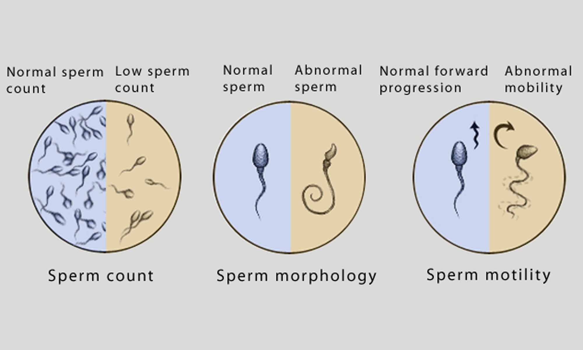 как можно улучшить морфологию спермы фото 95